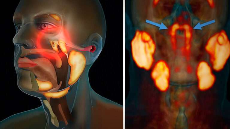 Scientists Uncover a Hidden Organ in the Human Body: The Surprising Discovery of the Tubarial Salivary Gland